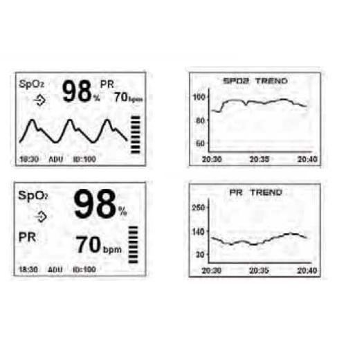 PULSIOSSIMETRO PALMARE CON ALLARMI, MEMORIA, DISPLAY GRAFICO, MODULO INTERNO, SENSORE NELLCOR OXIMAX e DI TEMPERATURA - ALLARMI: SpO2, BPM - COLLEGABILE A PC - TREND VISULIZZABILE GRAFICAMENTE - IDONEO PER IL MONITORAGGIO DI ADULTI, BAMBINI E NEONATI